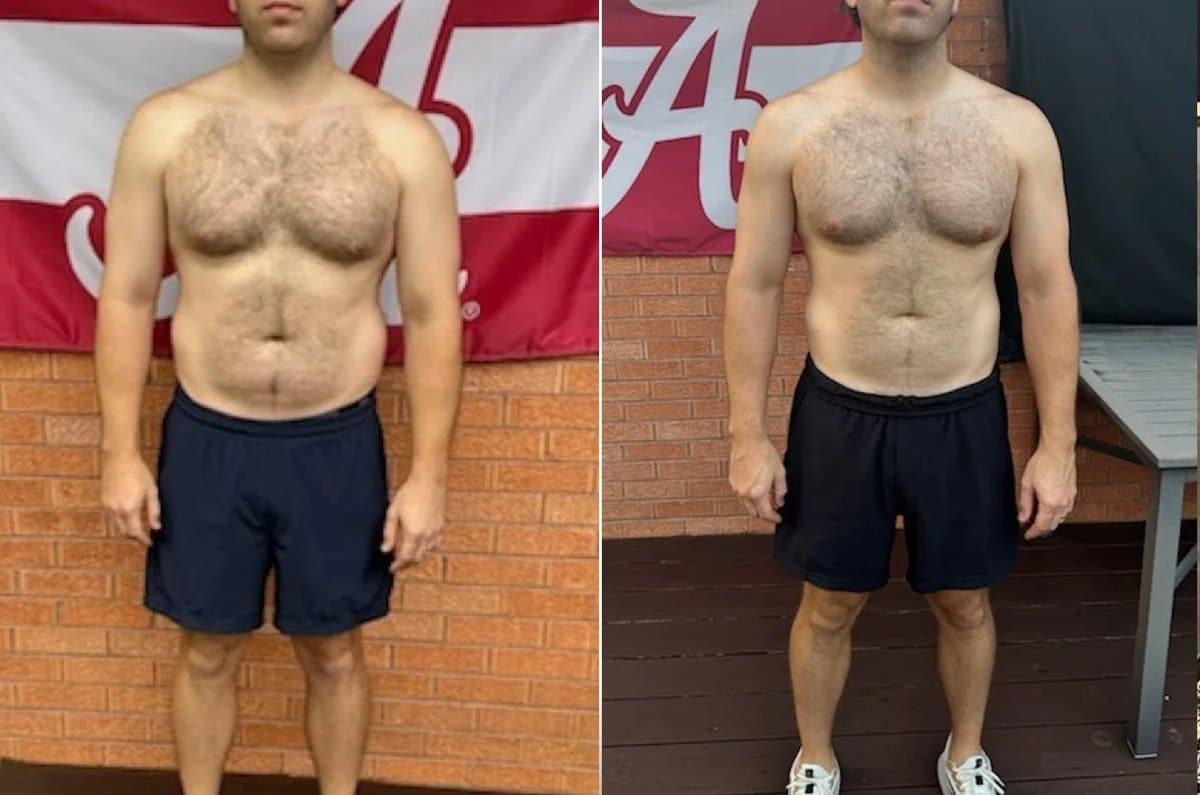 Patient transformation